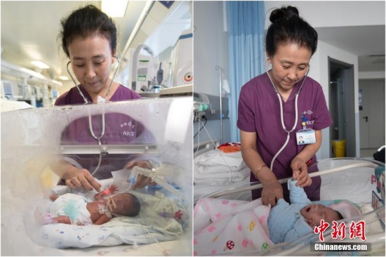 手掌嬰兒救治成功