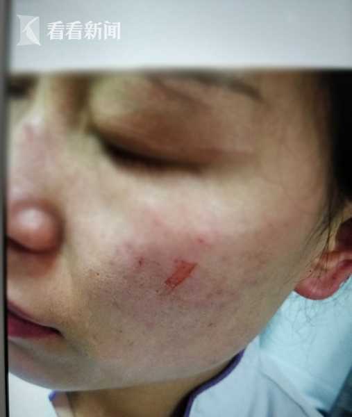 患者家屬調戲護士