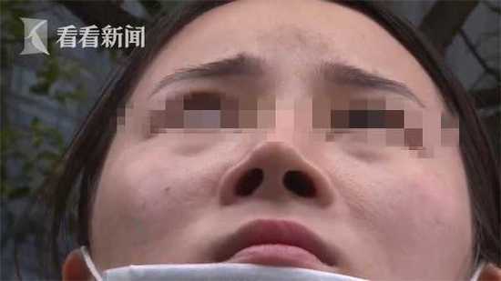 美女整鼻越整越歪 成都艾美薇醫療美容微整形
