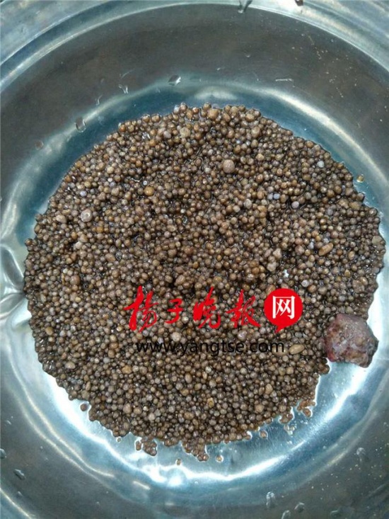 右腎2980顆結(jié)石