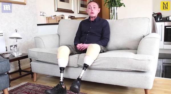 被愛犬舔舐后截肢