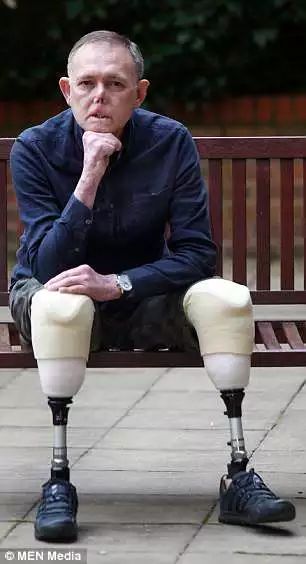 被愛犬舔舐后截肢