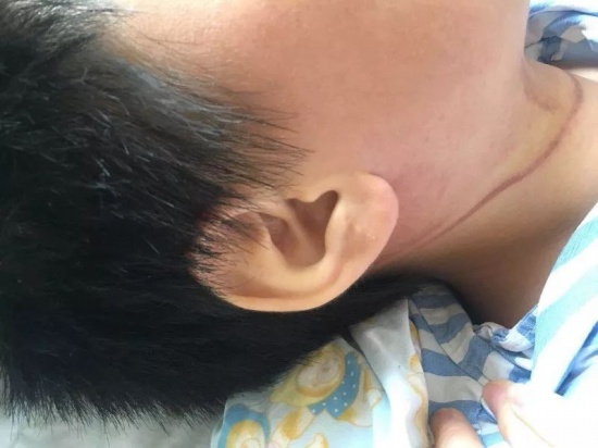 男孩腳一滑被上吊差點沒命