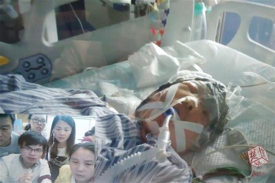 農婦頭發卷收割機 還未脫離生命危險