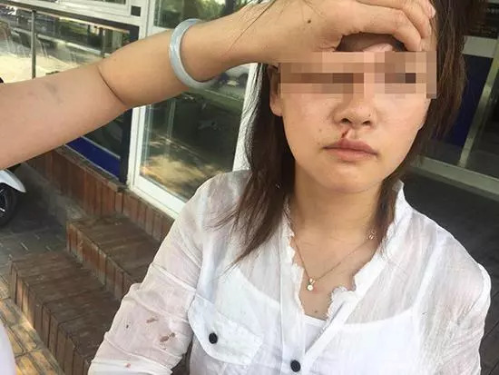 滴滴司機(jī)打傷乘客 女乘客吐口水惹事