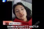 景區不救人先擺拍 鞏義長壽山風景區