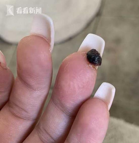 孕婦做美甲遭感染