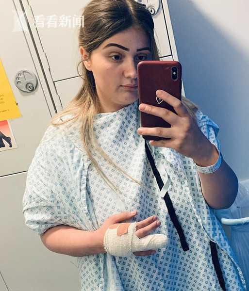 孕婦做美甲遭感染