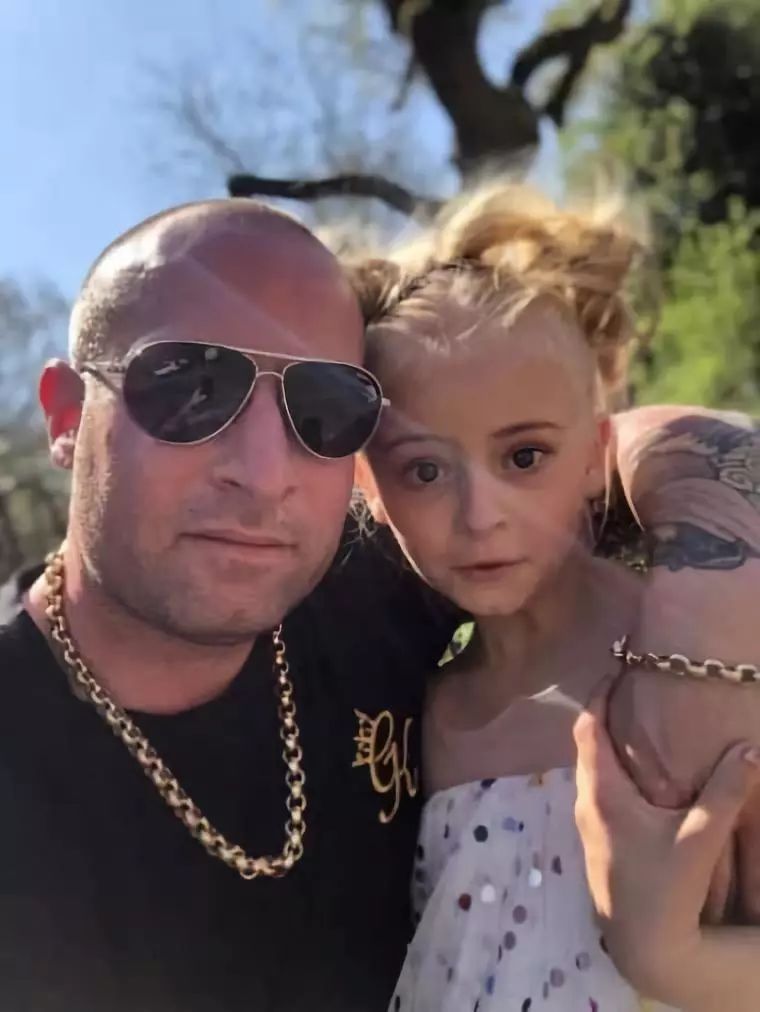 截肢仙女紅遍全球