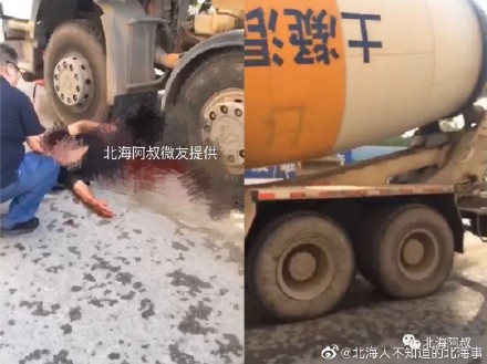 男子大腿被車輛壓在下面