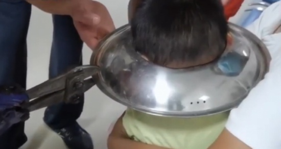 男孩腦袋卡進(jìn)鍋蓋取不下來