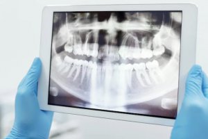 女子拔錯牙墜亡：安慶市立醫院醫生拔錯牙事件