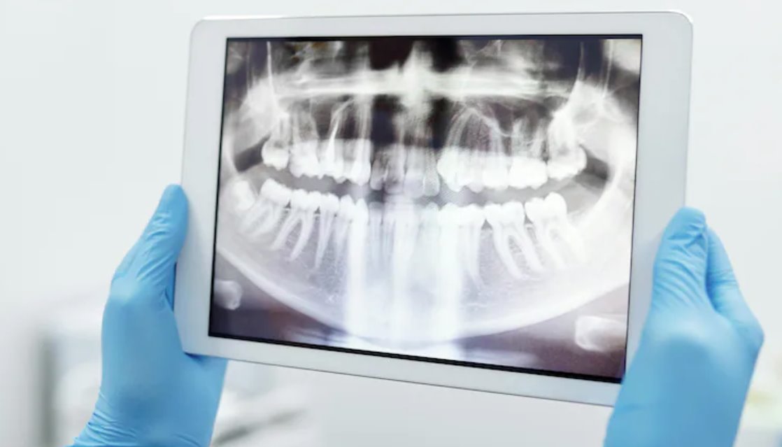 安慶市立醫院醫生拔錯牙